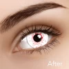 ILOCO Blood Shot Drops Contacts -Cosmetics Store bloodshot drops
