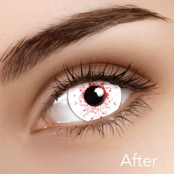 ILOCO Blood Shot Drops Contacts